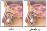 معجون واریکوسل وارداتی/طب سنتی هندی ایرانی ترکیب 16 گیاه +30 گرم ژل رویال گرید a